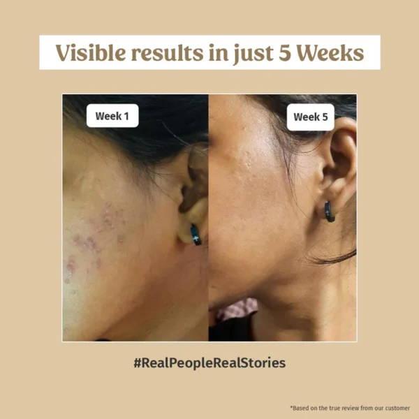 Skin Brightening Combo - Image 3